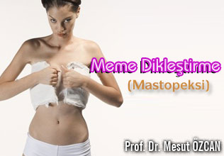 Meme dikleştirme (mastopeksi)