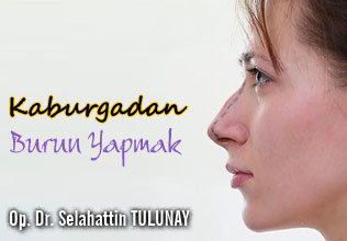 Kaburgadan burun yapmak