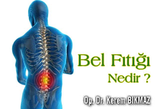 Bel fıtığı nedir? Cerrahi ve cerrahi dışı tedavisi nasıldır?