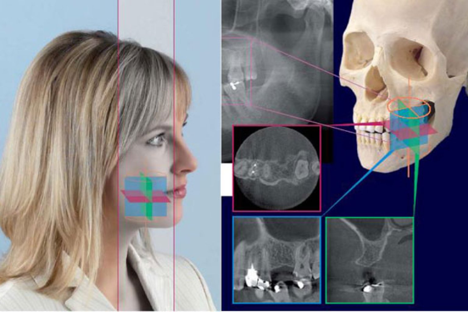Dental Tomografi Nedir?