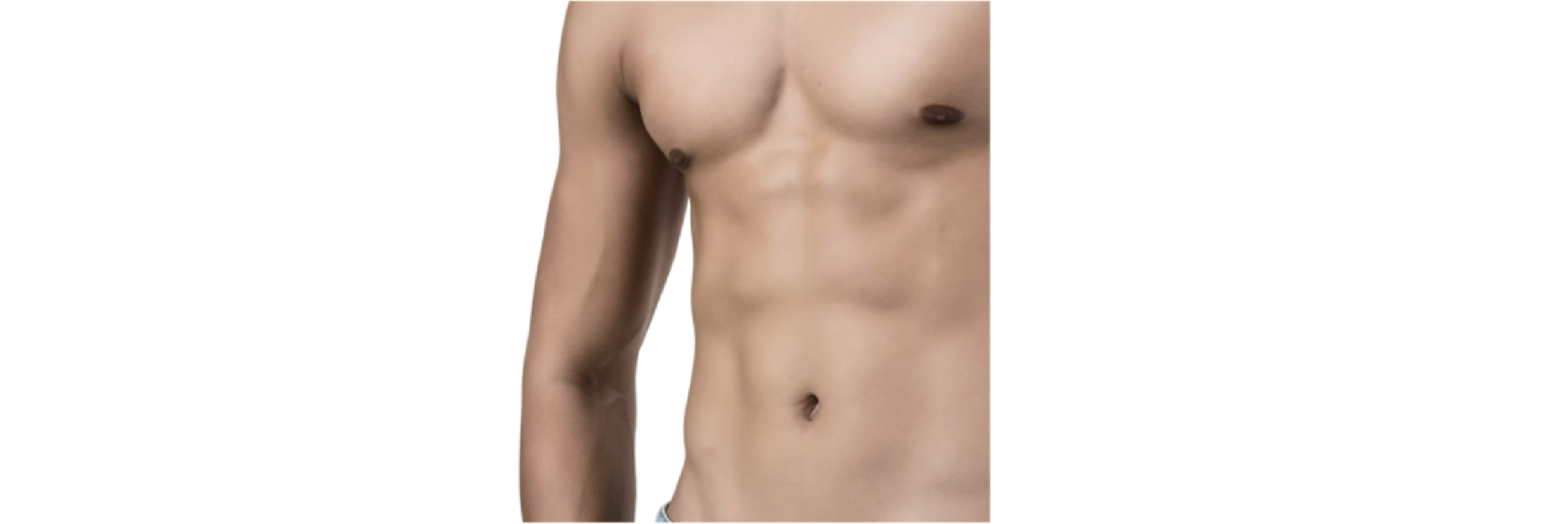 Jinekomasti Ameliyatı (Erkekte Meme Küçültme) makalesi