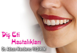 Diş Eti Hastalıkları makalesi