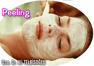 Peeling