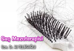 Saç Mezoterapisi