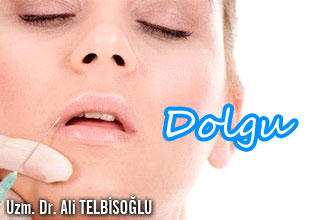 Dolgu