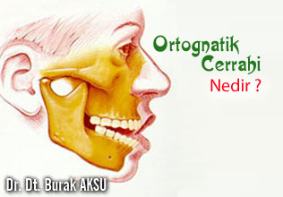 Ortognatik cerrahi nedir ? makalesi