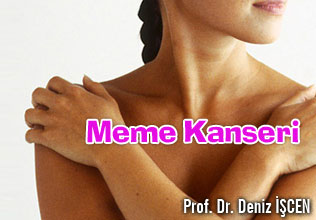Meme Kanseri