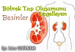 Böbrek taşı oluşumunu engelleyen besinler