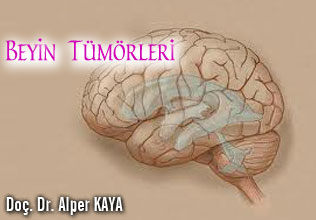 Beyin Tümörleri