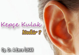 Kepçe kulak nedir ?