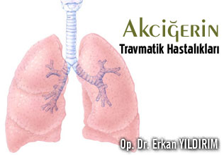 Akciğerin travmatik hastalıkları makalesi