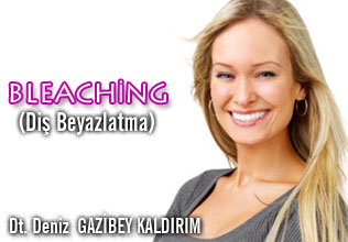 Bleaching (diş beyazlatma) beyaz dişler mutlu gülüşler