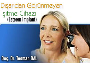 Dışarıdan görünmeyen işitme cihazı (esteem ımplant)