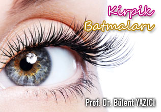 Kirpik batmaları