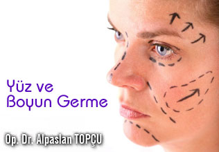Yüz ve boyun germe (face lift, rhytidectomy ve neck lift)