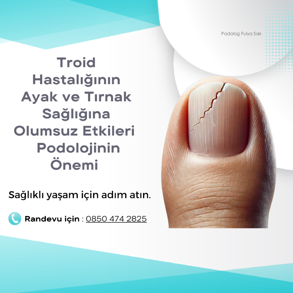 Tiroid Hastalıklarının Ayak Sağlığına Olumsuz Etkileri ve Podolojinin Önemi makalesi