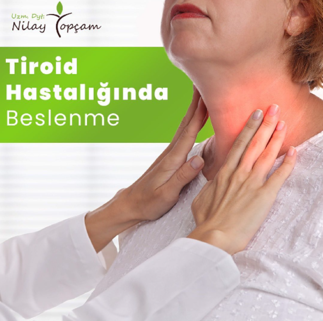 Tiroid Hastalarında Beslenme