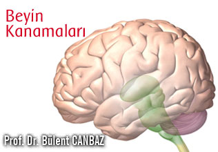 Beyin kanamaları!