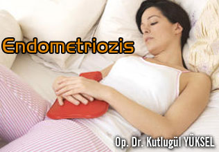 Endometriozis!