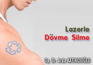 Lazerle dövme silme! makalesi