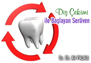 Diş çekimi ile başlayan serüven makalesi