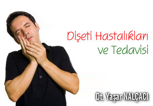 Dişeti hastalıkları ve tedavisi