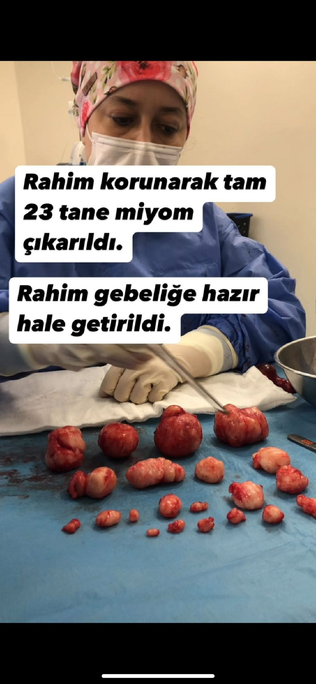 GENÇ VE ÇOCUK SAHİBİ OLMAK İSTEYEN HASTALARDA RAHİM KORUYUCU MİYOM AMELİYATI