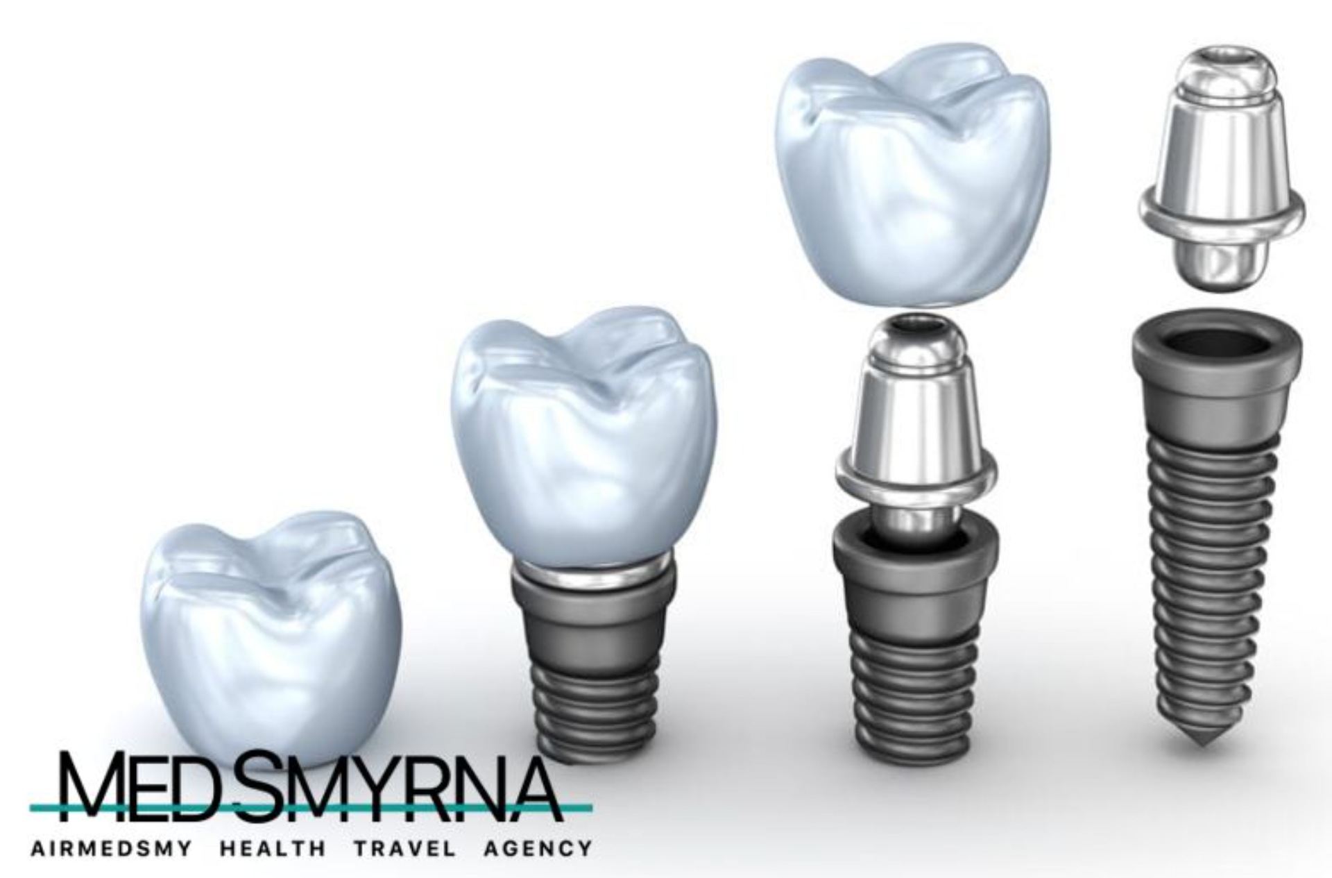 All on 4 Implant Tedavisi Nedir? makalesi