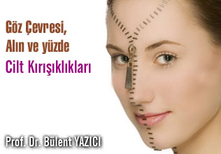 Göz çevresi, alın ve yüzde cilt kırışıklıkları