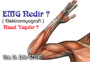 Elektromiyografi (emg) » emg nedir ? nasıl yapılır ?
