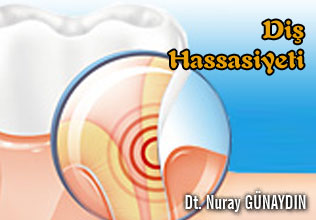 Diş Hassasiyeti makalesi