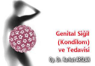 Genital siğil - kondilom ve tedavisi makalesi