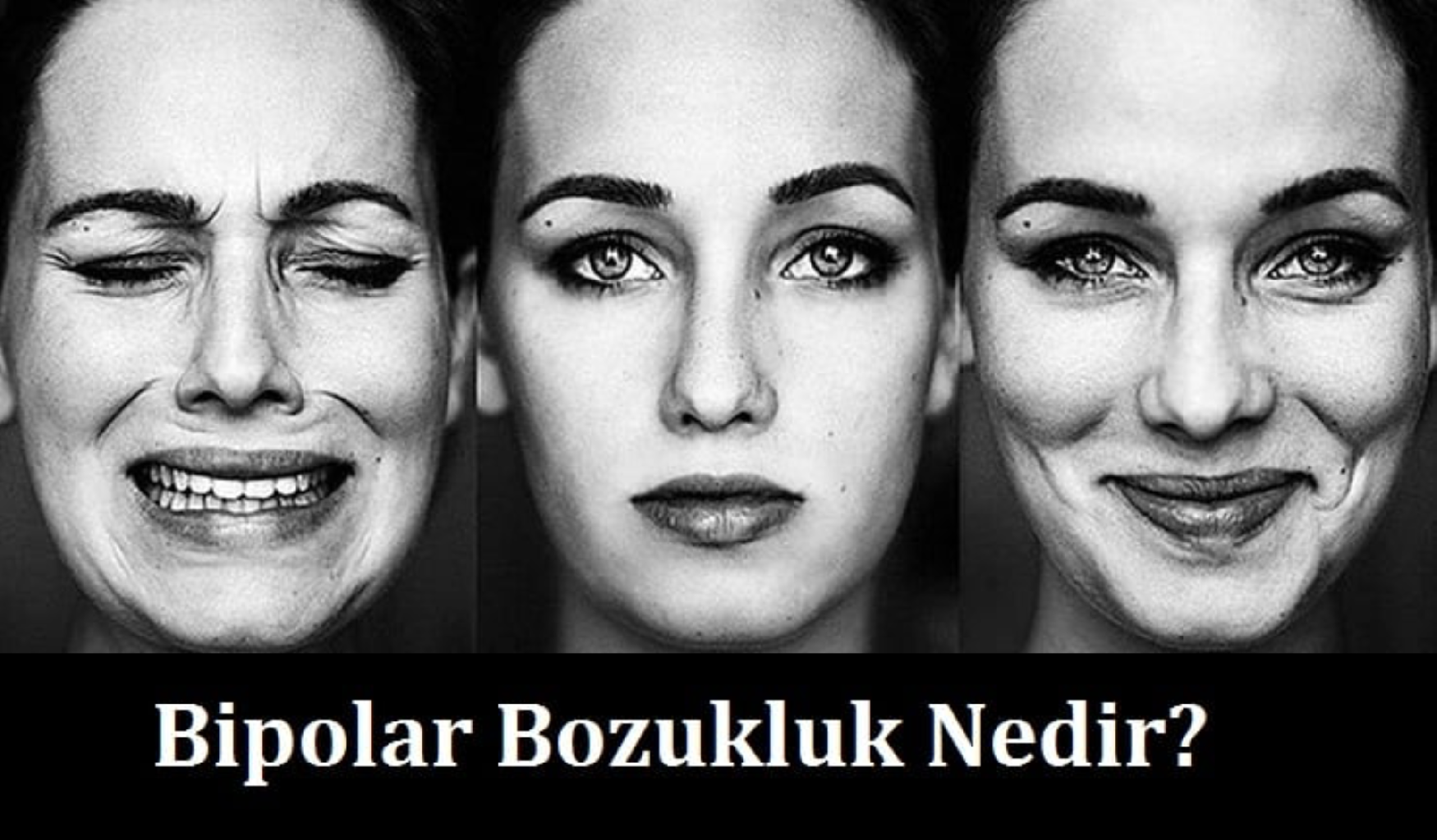 Bipolar Bozukluk Nedir?