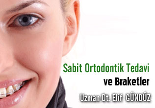 Sabit Ortodontik Tedavi ve Braketler