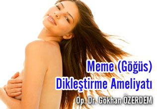Meme (göğüs) dikleştirme ameliyatı