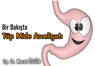 Bir bakışta tüp mide ameliyatı