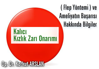Kalıcı kızlık zarı onarımı ( flep yöntemi ) ve ameliyatın başarısı hakkında bilgiler makalesi