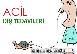 Acil diş tedavisi gerektiren sorunlar