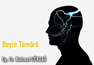 Beyin Tümörü makalesi