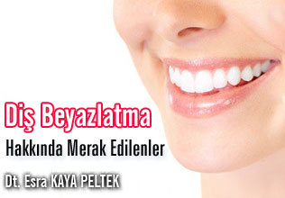 Diş Beyazlatma Hakkında Merak Edilenler makalesi