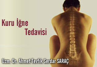 KURU İĞNE TEDAVİSİ