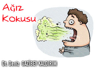 Ağız boşluğu kaynaklı ağız kokusunun tedavisi