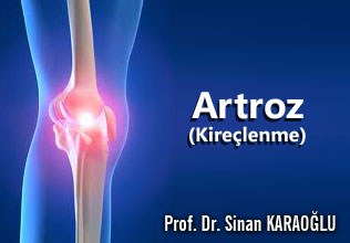 Artroz (Kireçlenme) ve Tedavisi makalesi