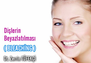 Dişlerin beyazlatılması ( bleaching)