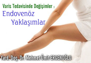 Varis tedavisinde değişimler: endovenöz yaklaşımlar