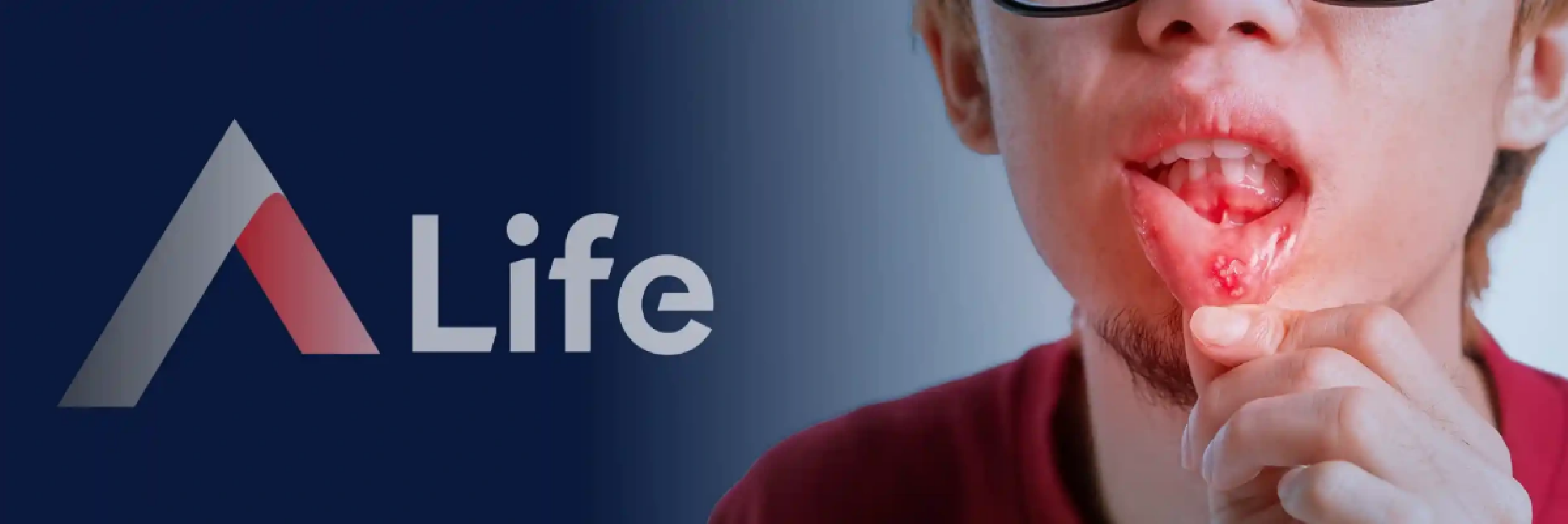 Aftöz Ülser Neden Oluşur?