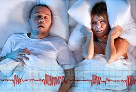 Sleep Apnea (uykuda solunum durması) nedir ?