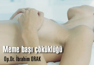 Meme başı çöküklüğü