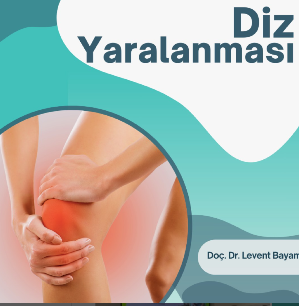 Diz Yaralanması makalesi