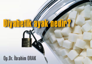 Diyabetik ayak nedir?